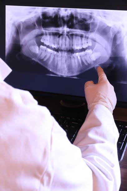 Best Emergency Wisdom Tooth Extraction in Shpee Neck, MA
