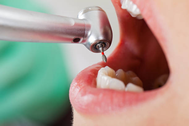 Best Walk-In Emergency Dental Services in Shpee Neck, MA